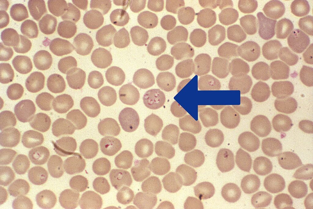 Paraziți Babesia la microscop